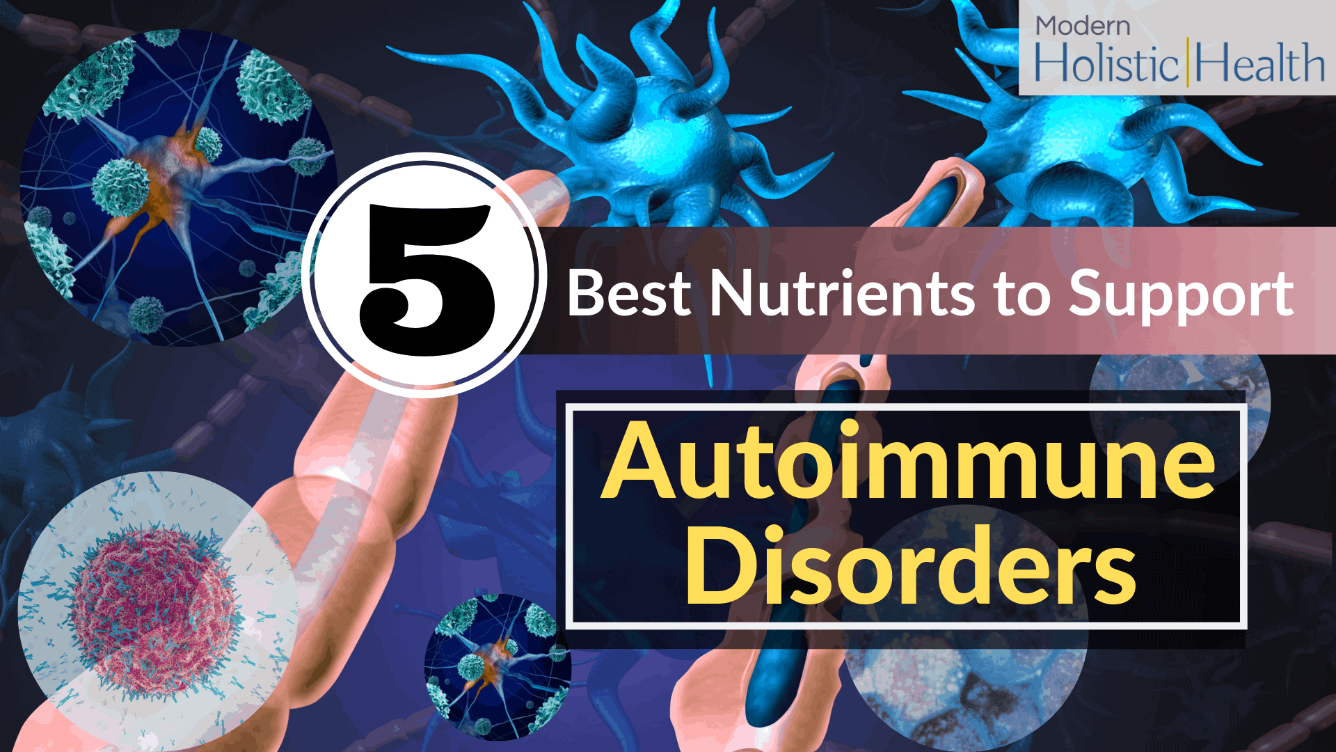 5-best-nutrients-to-support-autoimmune-disorders-modern-holistic-health