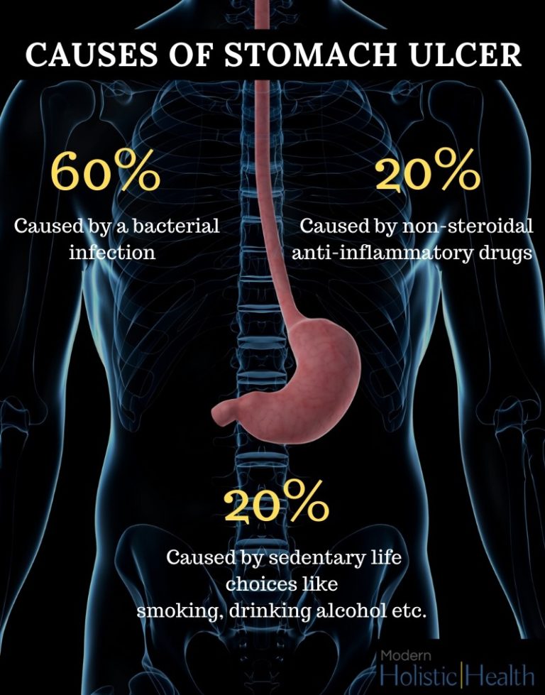 can-stomach-ulcers-cause-headaches-and-dizziness-headachestory