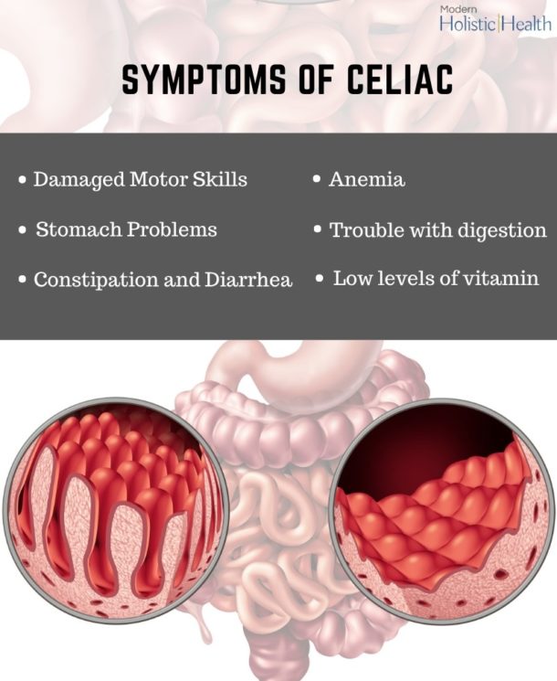 The Difference Between Celiac, Gluten Intolerance, And Wheat Allergies